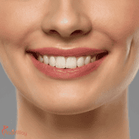 عملية تجميل الغمازات في جانجنام: أحدث جراحات التجميل في كوريا الجنوبية